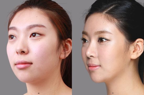 郑州隆鼻和鼻修复专家有哪些？哪个专家更好呢？
