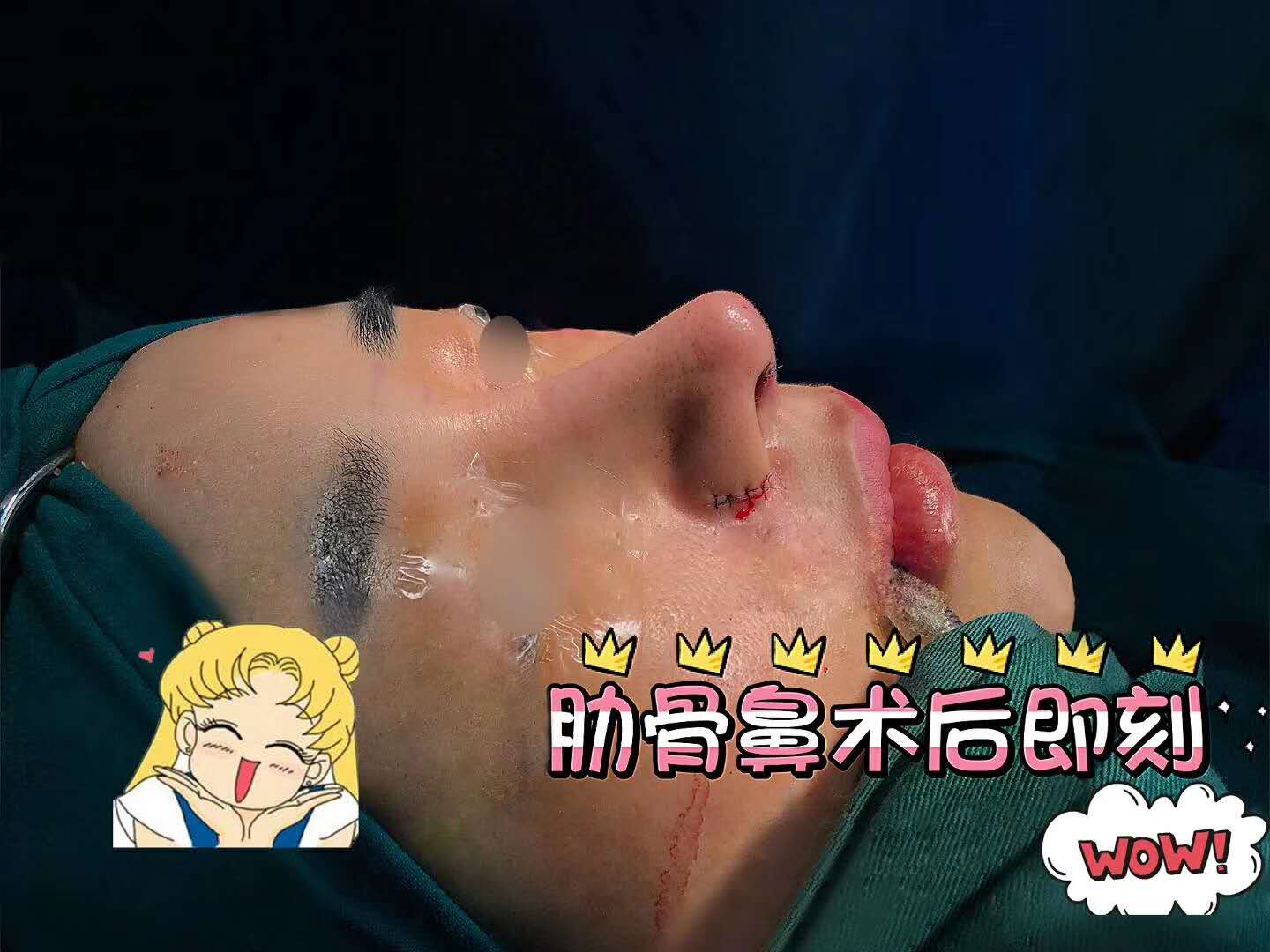 北京隆鼻专家前十名，北京隆鼻医生排行榜
